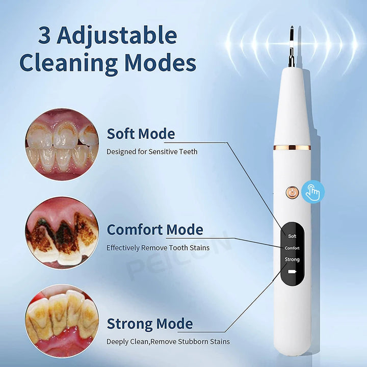 Ultrasonic Dental Cleaner – Tartar & Stain Remover